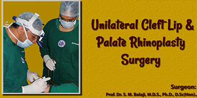 Unilateral Cleft Lip and Palate Rhinoplasty Surgery
