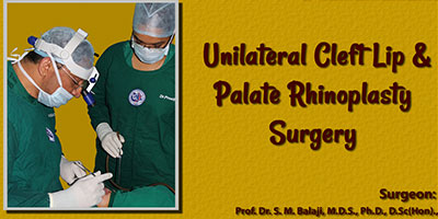 Unilateral Cleft Lip & Palate Rhinoplasty Surgery