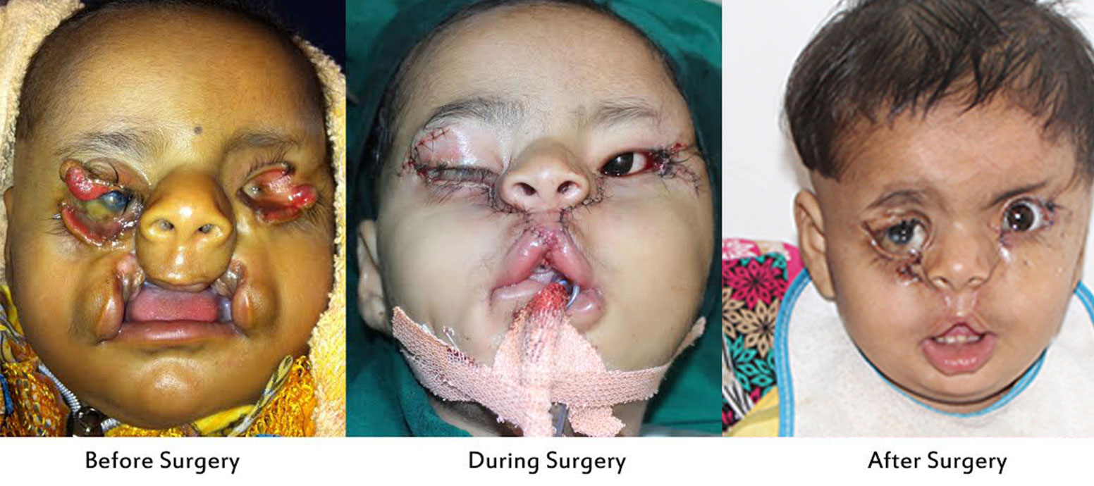 Best Facial Reconstructive Surgeon In India