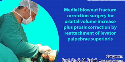 Medial blowout fracture correction surgery for orbital volume increase plus ptosis correction by reattachment of levator palpabrae superioris