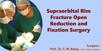 Supraorbital rim Fracture Open Reduction Internal Fixation (ORIF) Surgery