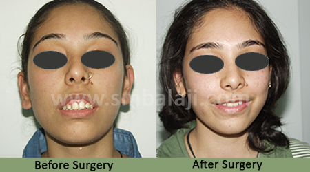 Best Maxillofacial Surgeon In India