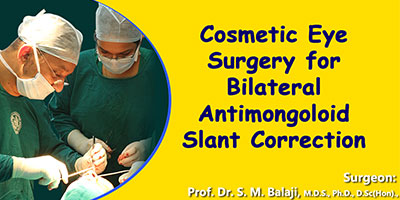 Cosmetic Eye Surgery, Facial cosmetic surgery India