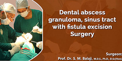 Facial cosmetic surgery for abscess sinus tract removal and extraction of abscessed tooth