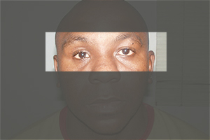 Eye Injuries 5 Facial Trauma Emergency Surgery Chennai