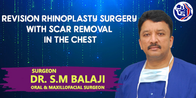 Revision Rhinoplasty Surgery with Scar Removal in the Chest