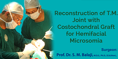 TMJ reconstruction surgery with costochondral graft for hemifacial microsomia