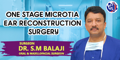 One stage microtia ear reconstruction surgery