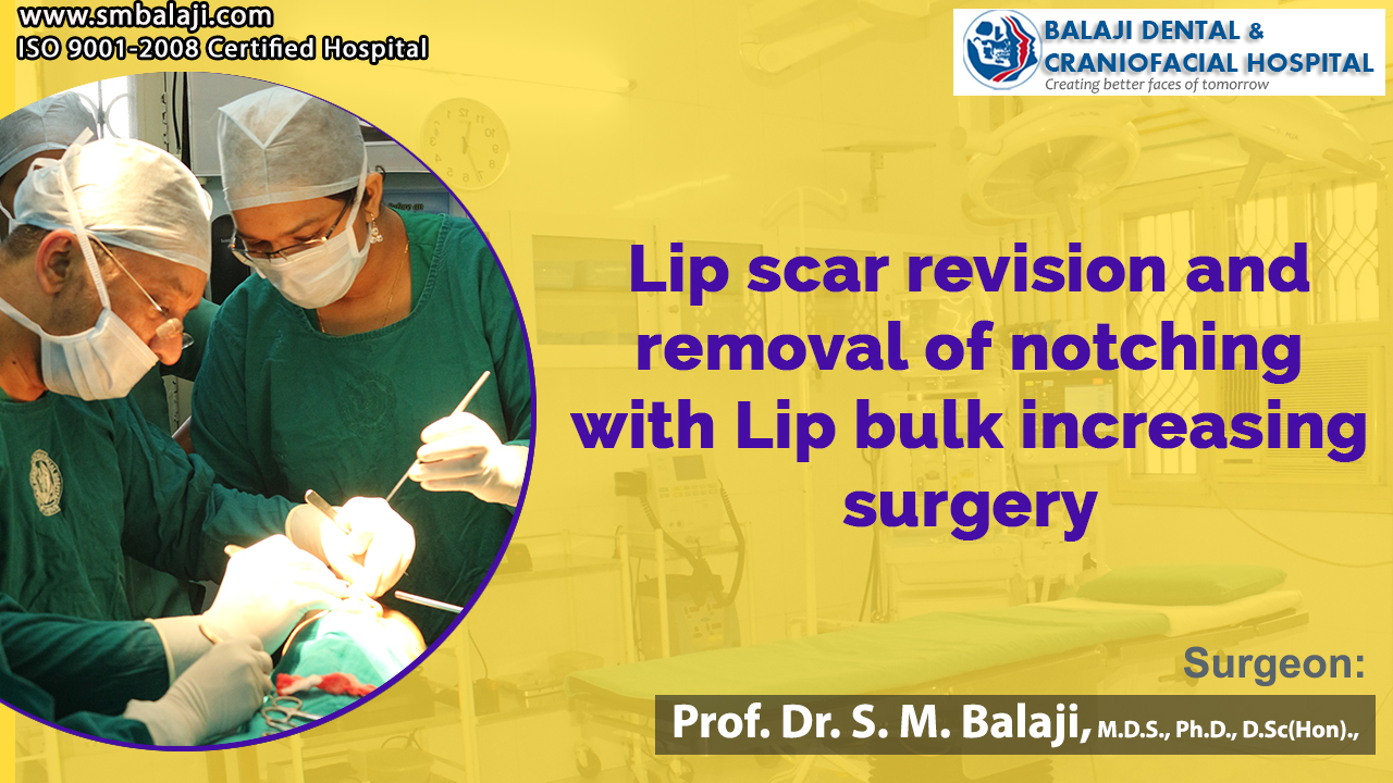 Scar removal Surgery in India