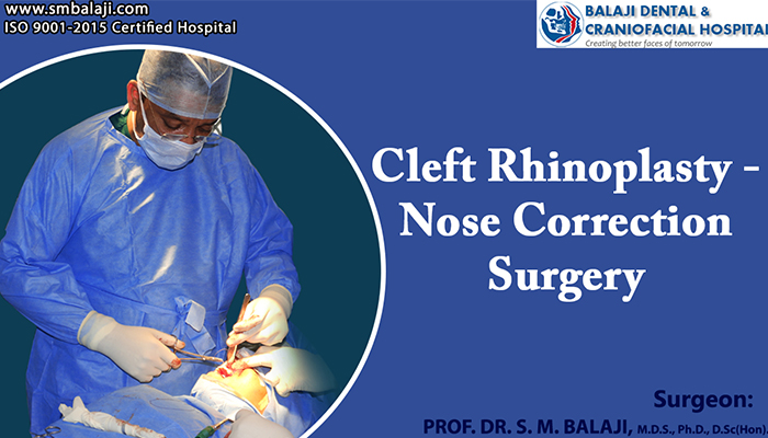 cleft rhinoplasty india