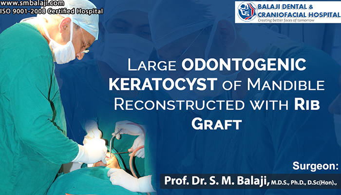 Jaw reconstruction surgery with bone graft after removal of odontogenic keratocyst