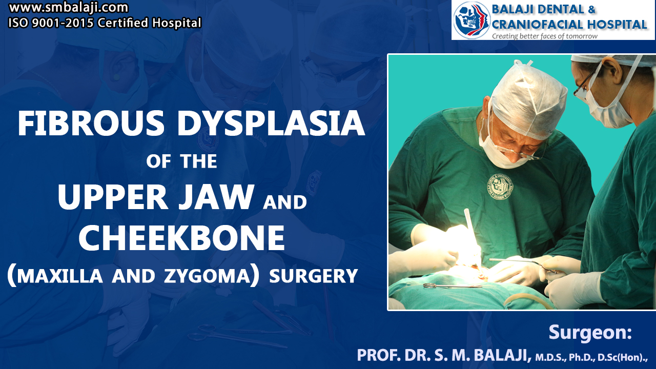 Fibrous Dysplasia of the Upper jaw and Cheekbone