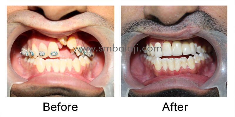 Patient Before & After