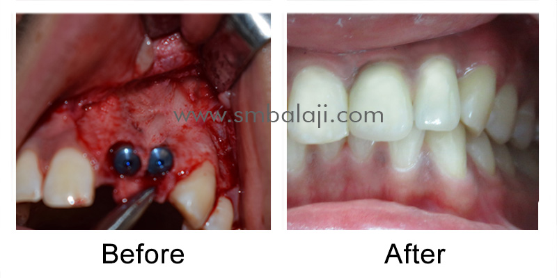 Patient pre-operative & post- operative