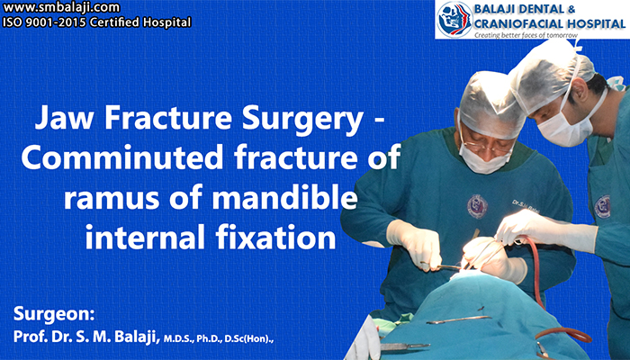 Jaw Fracture Surgery chennai india