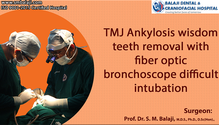 TMJ Ankylosis surgery india