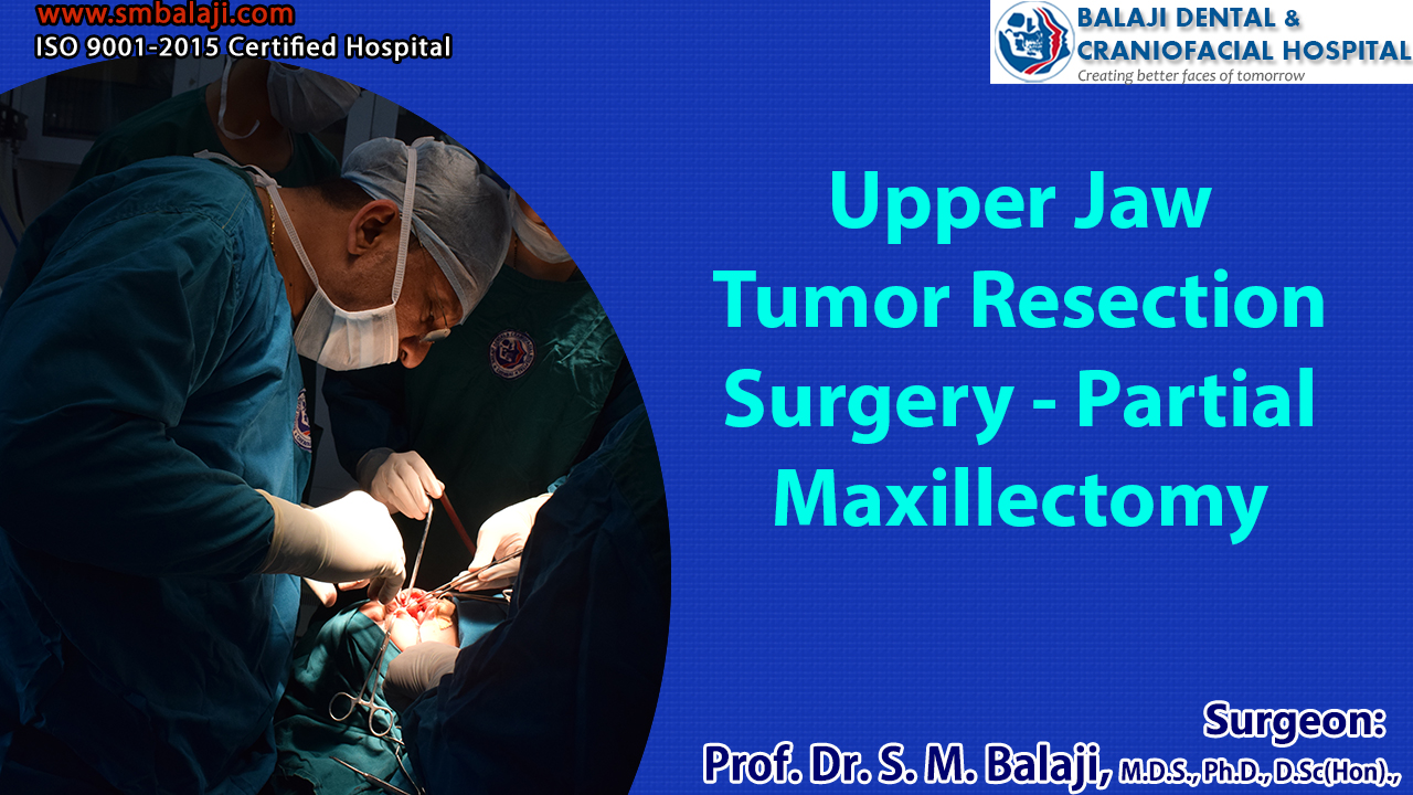 Tumor resection Surgery India