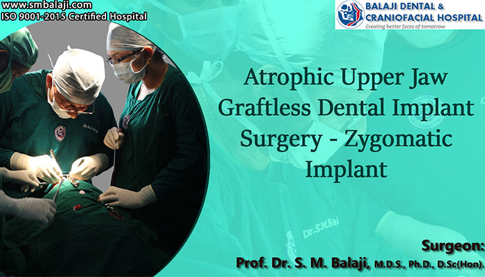 Atrophic upper jaw graftless Dental implant surgery | Zygomatic Implant