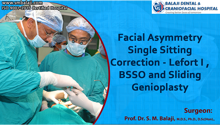 Facial Asymmetry Single Sitting Correction – Lefort I, BSSO and Sliding Genioplasty