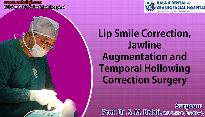 Smile Correction Chennai