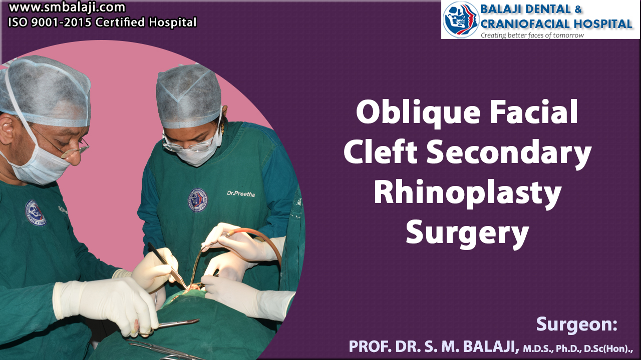 Oblique Facial Cleft Secondary Rhinoplasty Surgery