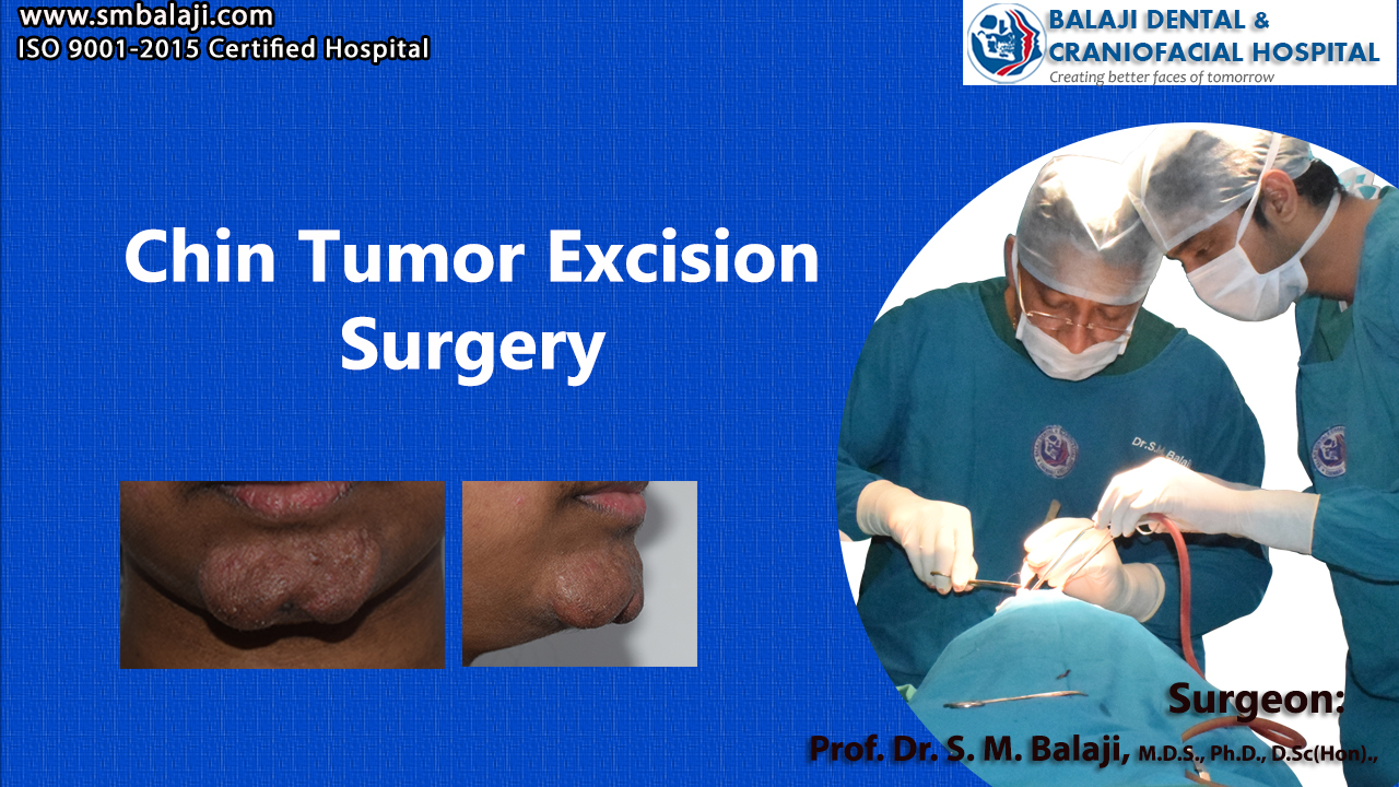 Chin Tumor Excision Surgery