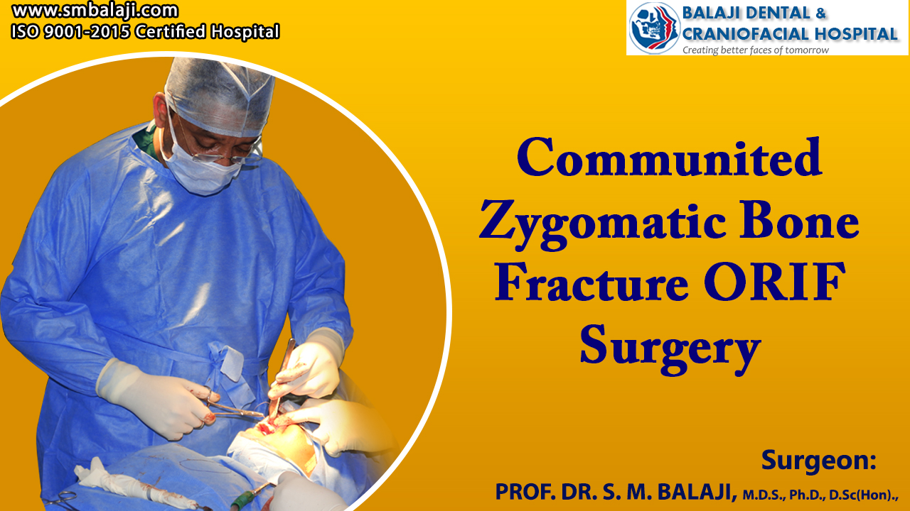 Comminuted Zygomatic Bone Fracture ORIF Surgery
