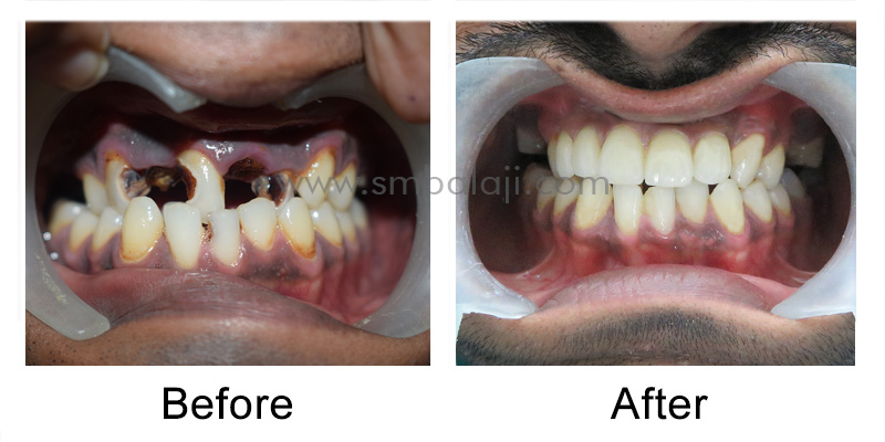 Patient before and after rehabilitation