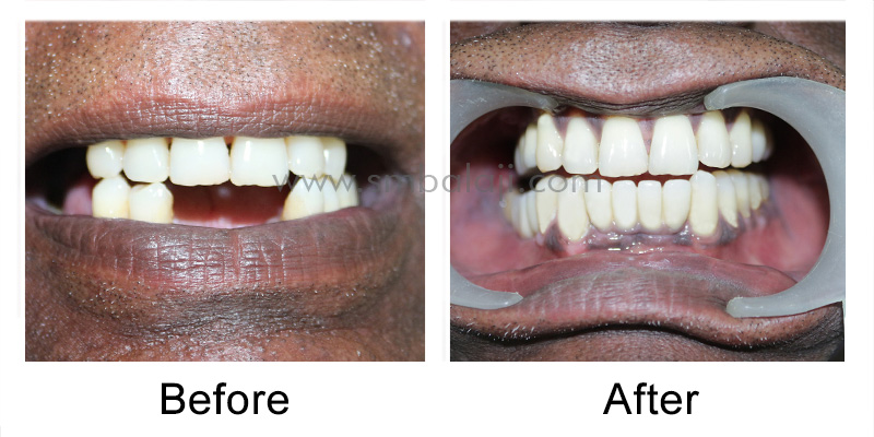 Patient Before And After Makeover