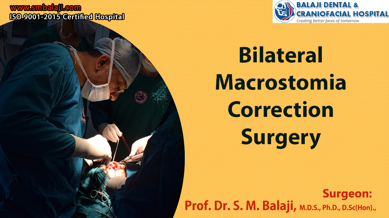 Bilateral Macrostomia Correction Surgery