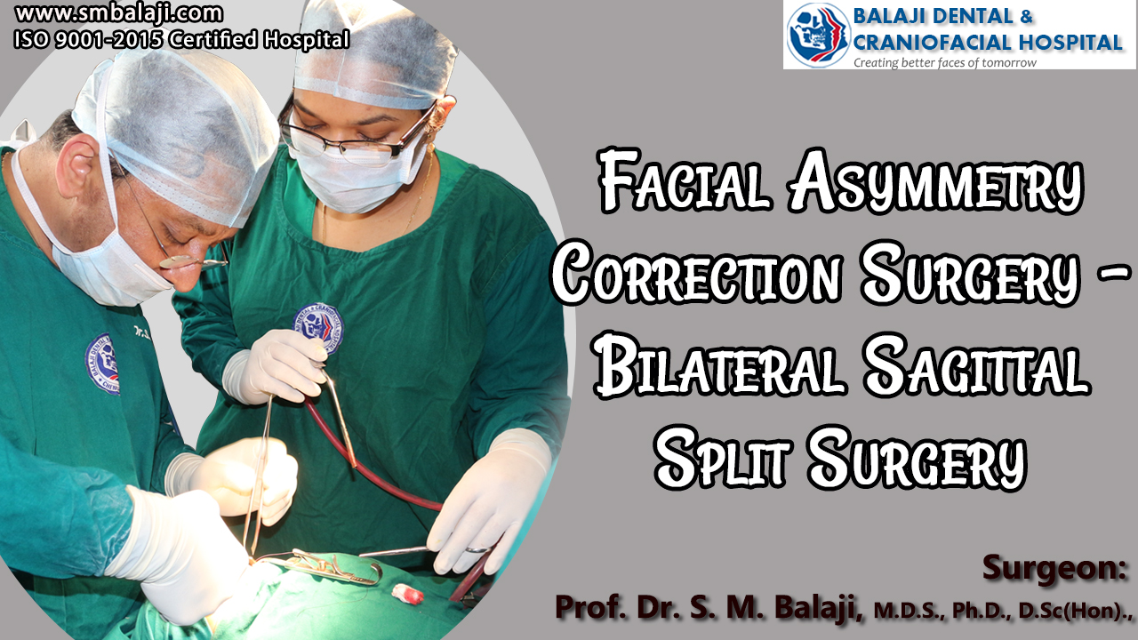 Facial Asymmetry Correction Surgery - Bilateral Sagittal Split Surgery