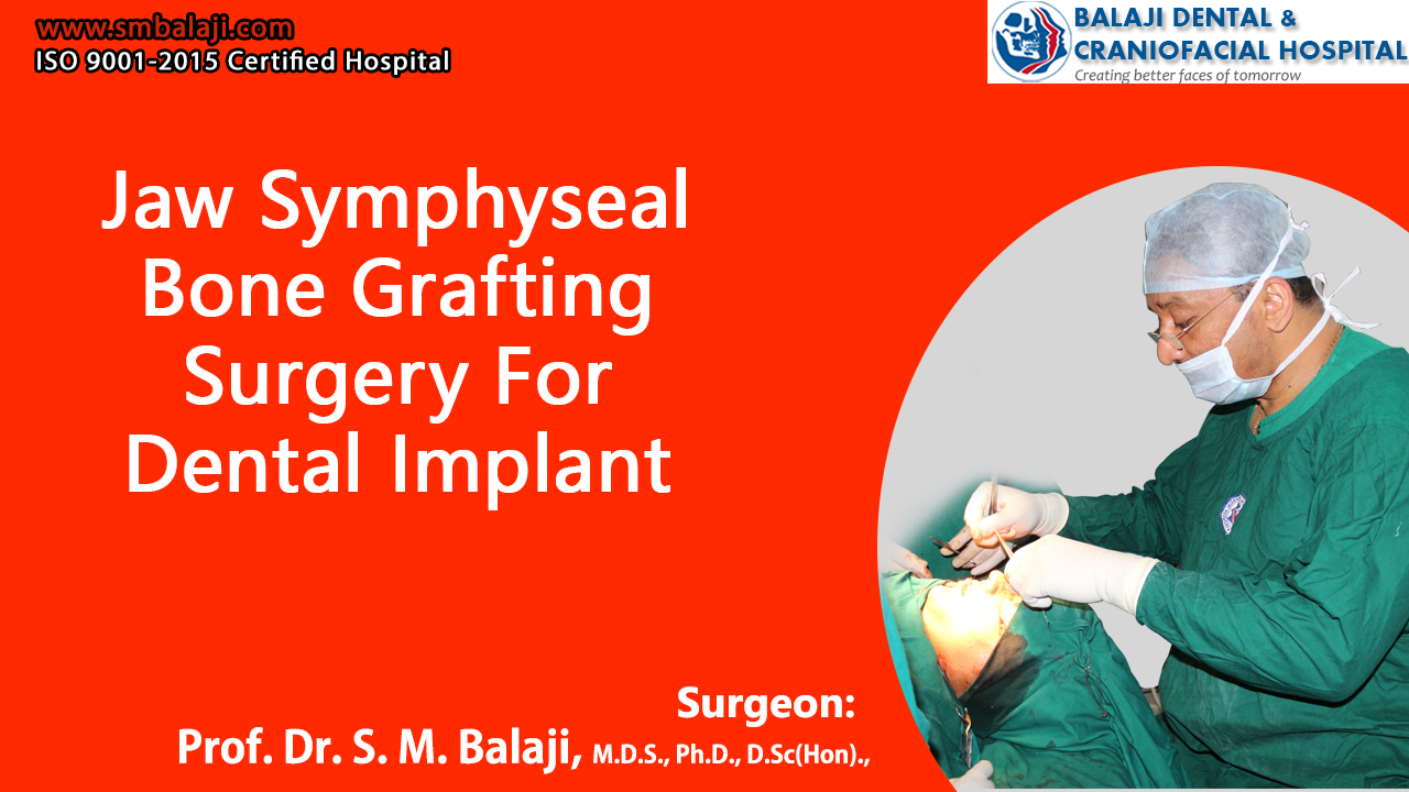 Jaw symphyseal bone grafting surgery for dental implant