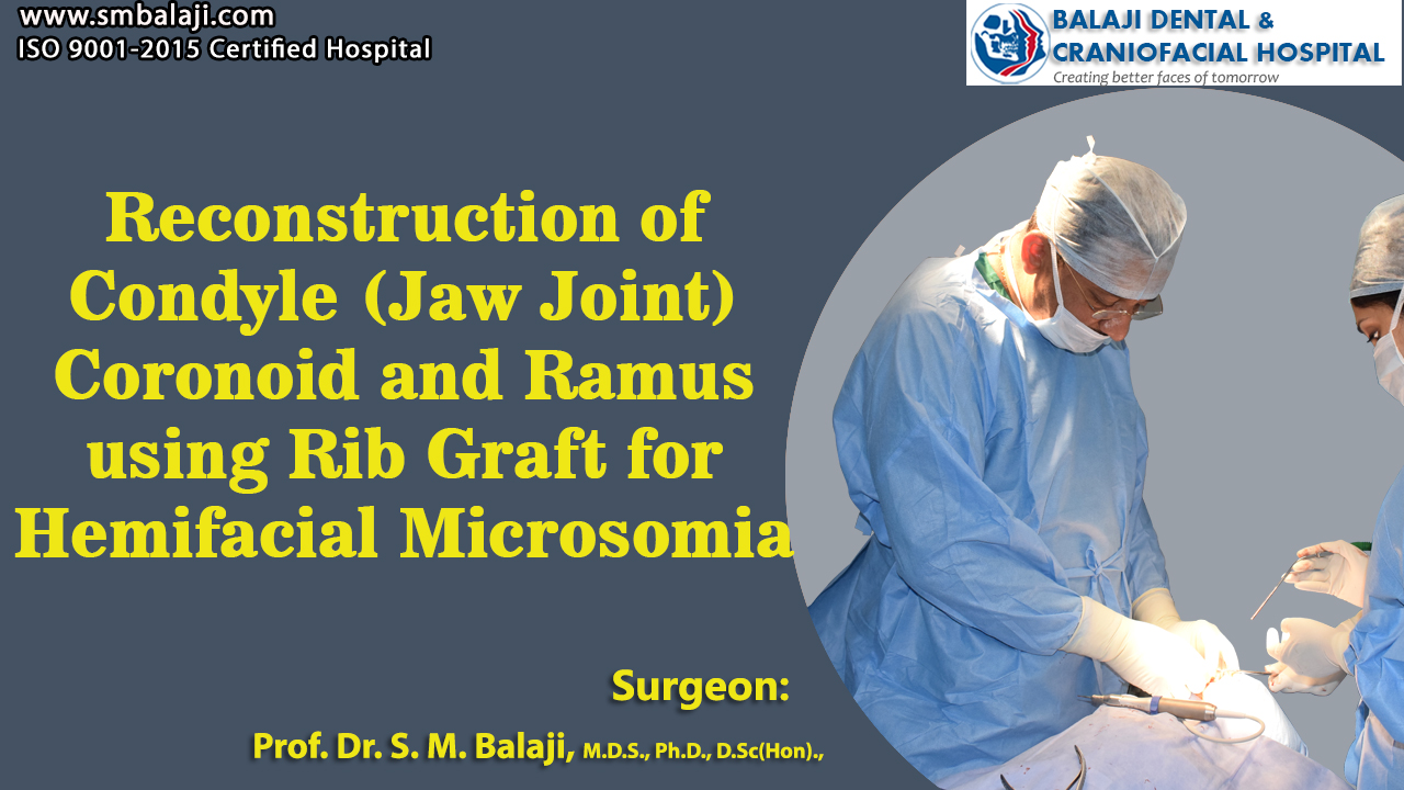 Reconstruction of Condyle (Jaw Joint) Coronoid and Ramus using rib graft for hemifacial Microsomia