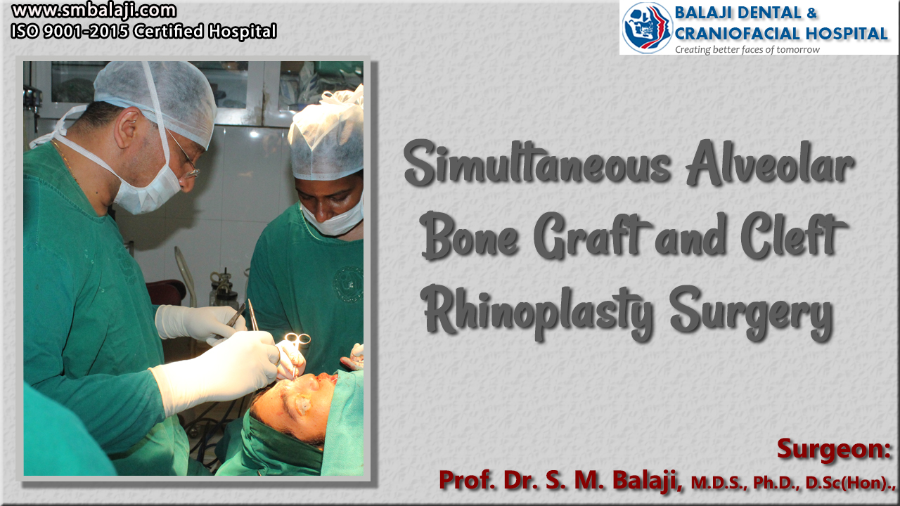 Simultaneous Alveolar Bone Graft and Cleft Rhinoplasty Surgery