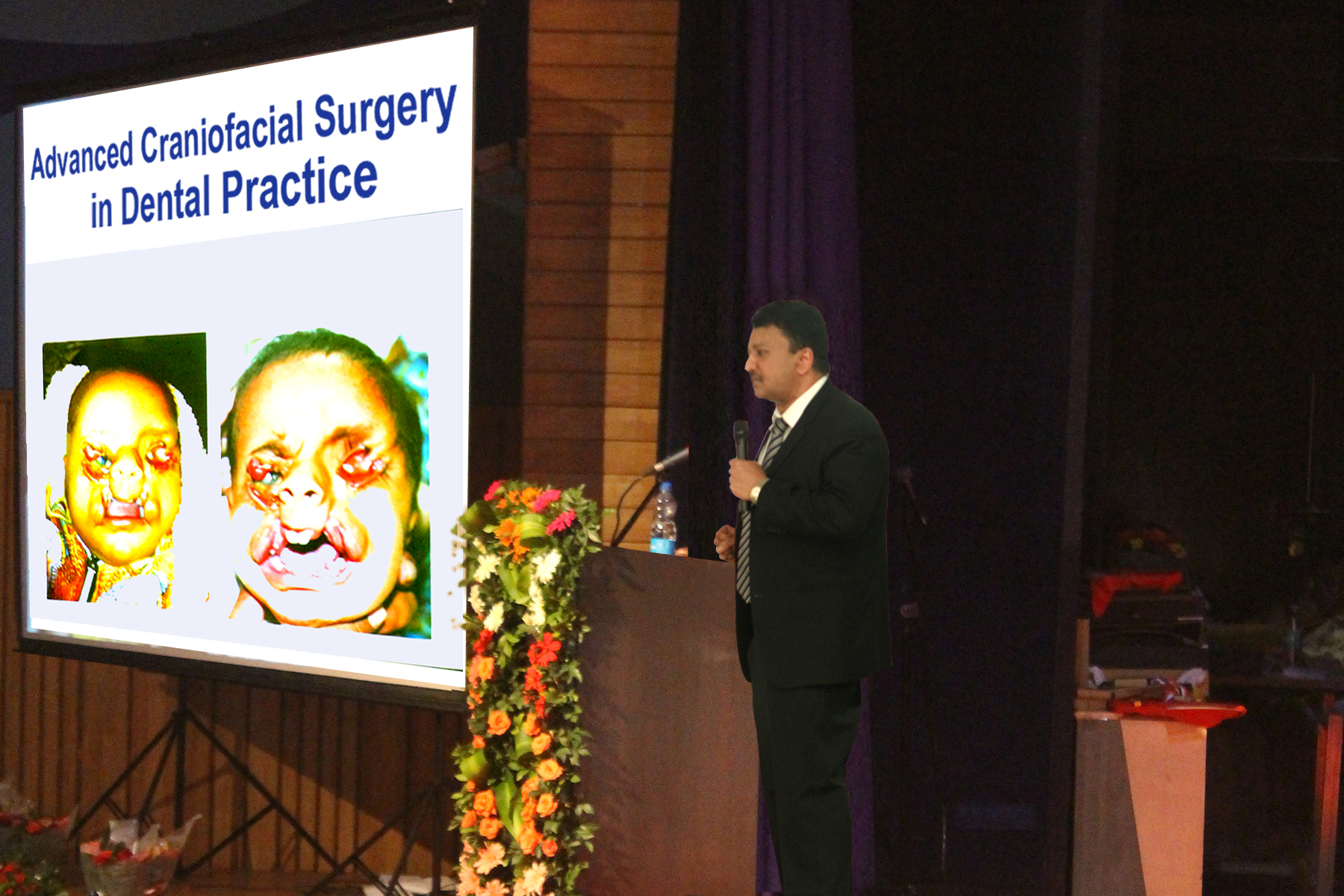31st Indian Society for Dental Research - International Association for Dental Research Annual Conference, Mumbai 12 Dr Balaji Delivered A Lecture On Advanced Craniofacial Surgery In Dental Practice, Which Was Very Well Received By The Audience
