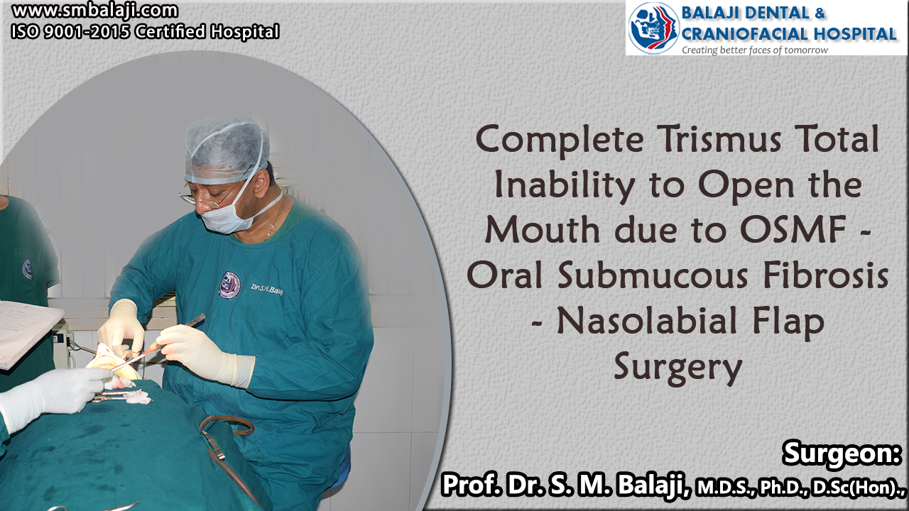 Complete Trismus total inability to open the mouth due to OSMF - Oral Submucous Fibrosis – Nasolabial Flap Surgery