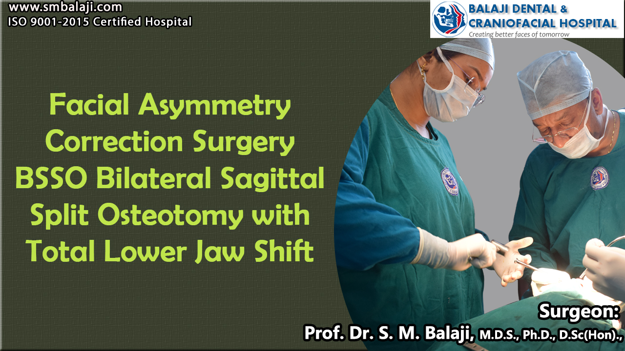 Facial Asymmetry Surgery BSSO Bilateral Sagittal Split osteotomy with Total Lower Jaw Shift
