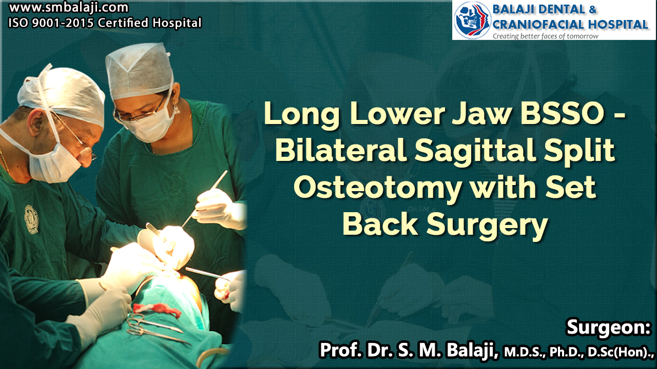 Long Lower Jaw BSSO - Bilateral Sagittal Split Osteotomy with Set Back Surgery