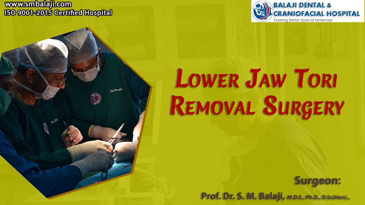 Jaw Tori Removal Surgery