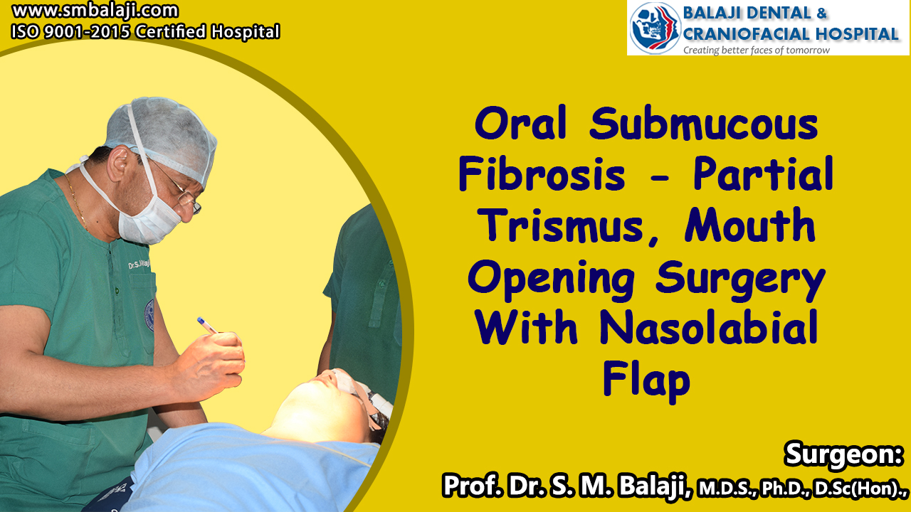 Oral Submucous Fibrosis - partial Trismus Mouth Opening Surgery With Nasolabial Flap Surgery