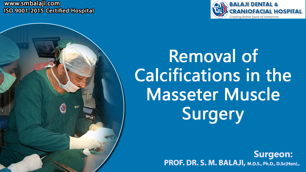 Removal of Calcifications in the masseter muscle surgery