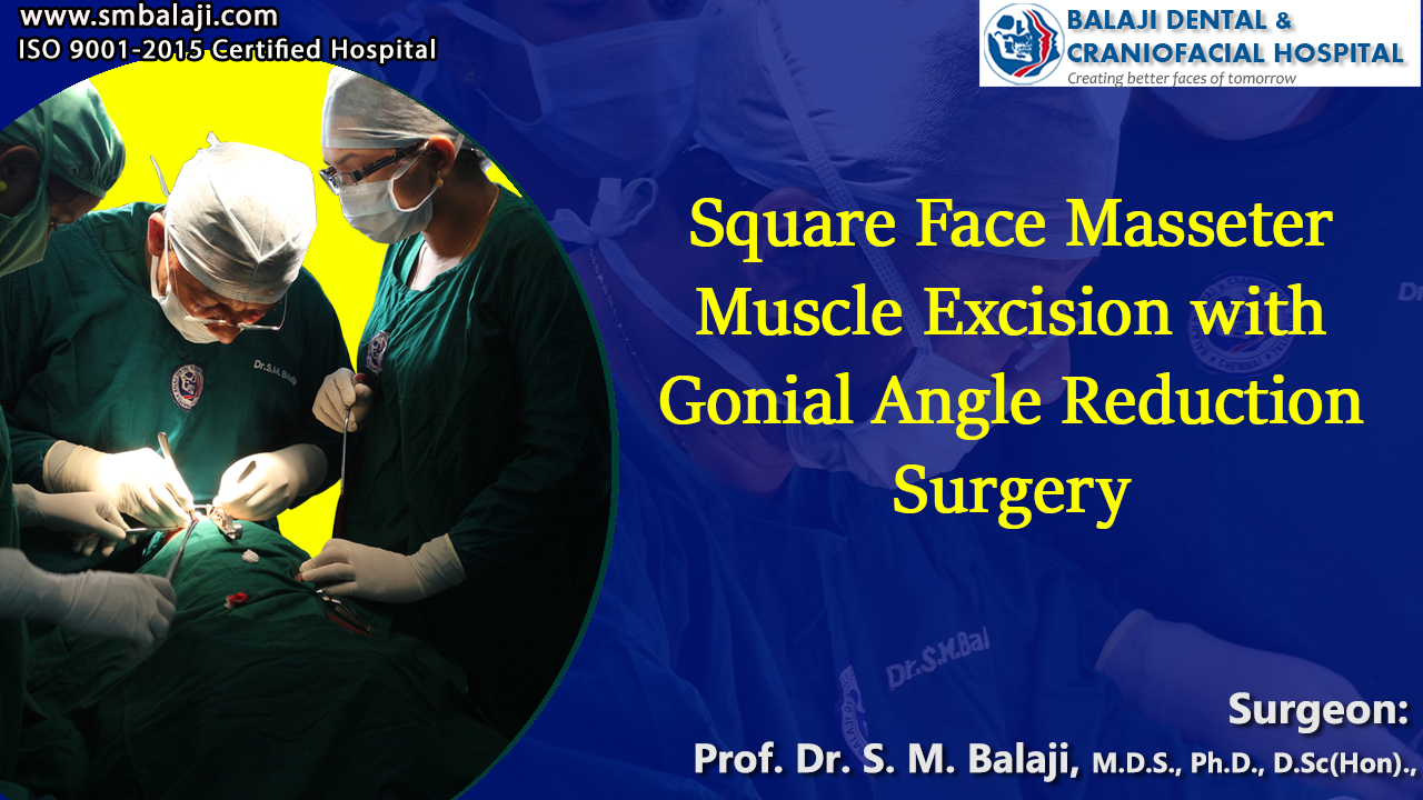 Square Face, Masseter Muscle Excision failed - Resurgery with Gonial Angle Reduction