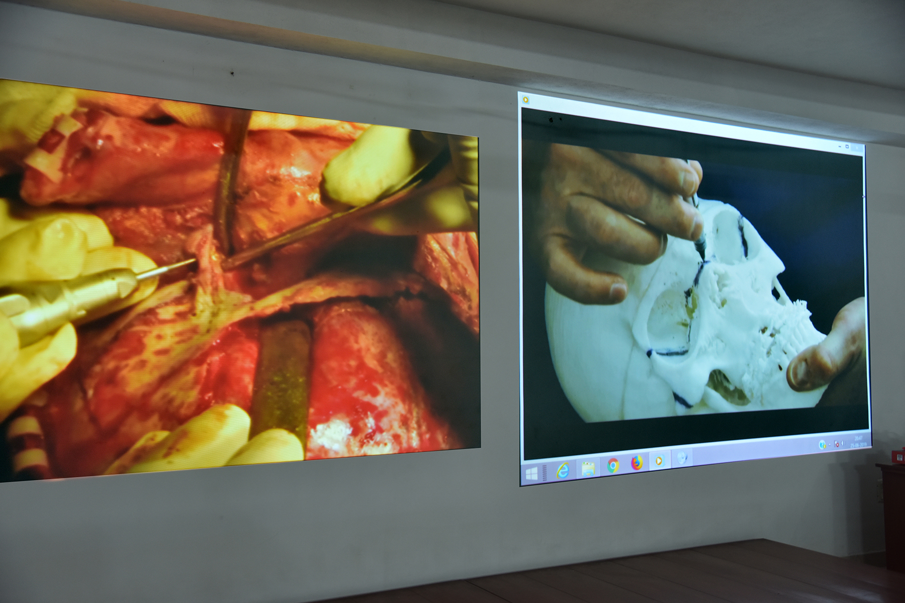 Visit of Dr Andrew Edwards, Dean-Elect, Faculty of Dentistry, Royal College of Surgeons, Glasgow 19 A View Of Patient Videos