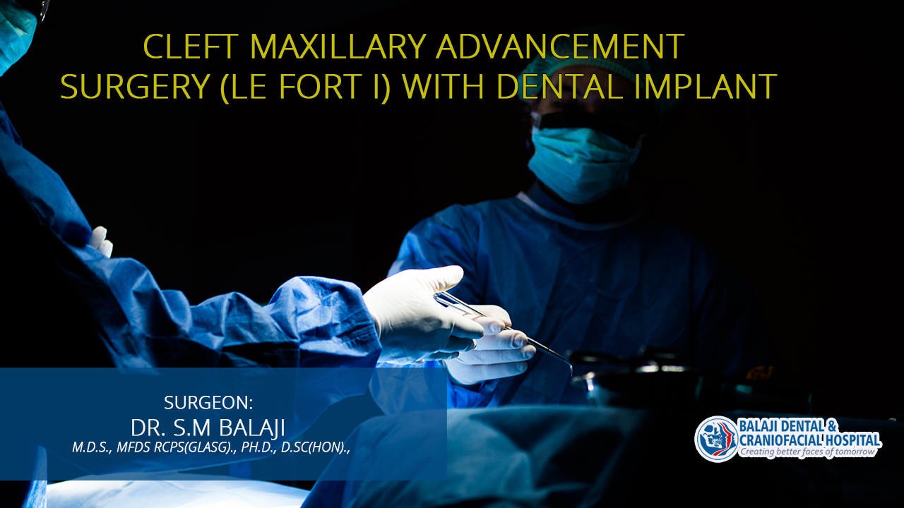 Cleft Maxillary Advancement Surgery (Le Fort I) With Dental Implant