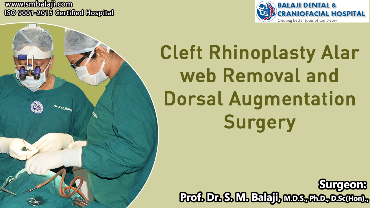 Cleft Rhinoplasty Alar web Removal and Dorsal Augmentation Surgery