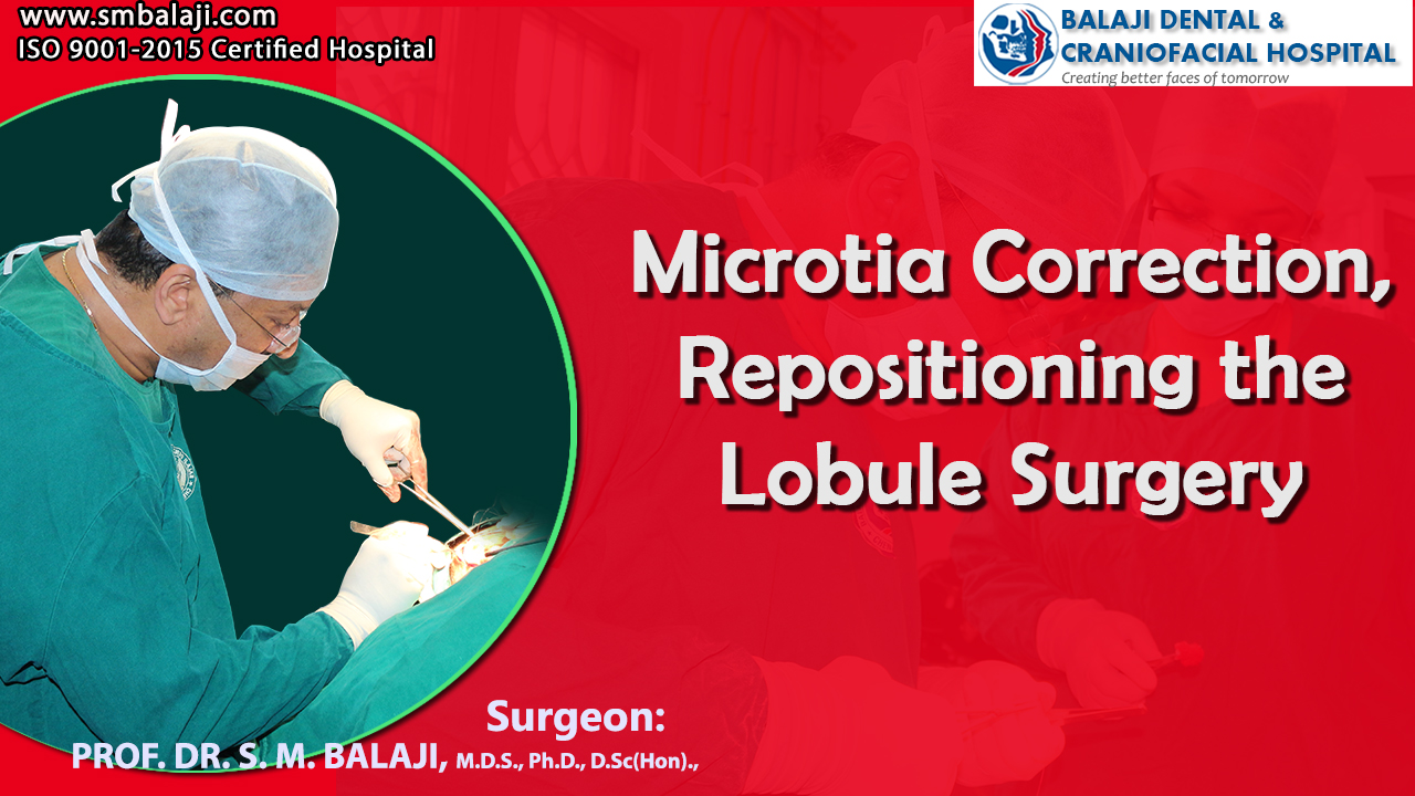 Microtia Correction, Repositioning the Lobule Surgery