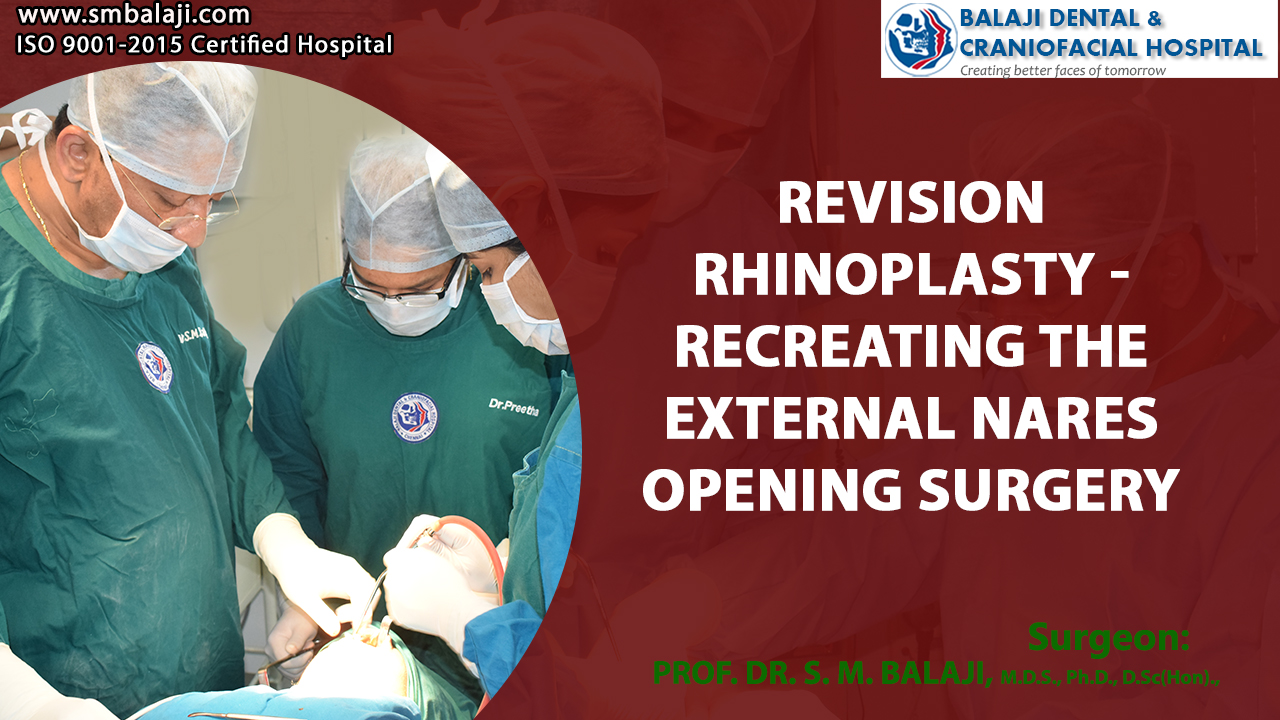 Revision rhinoplasty – Recreating the External Nares Opening Surgery