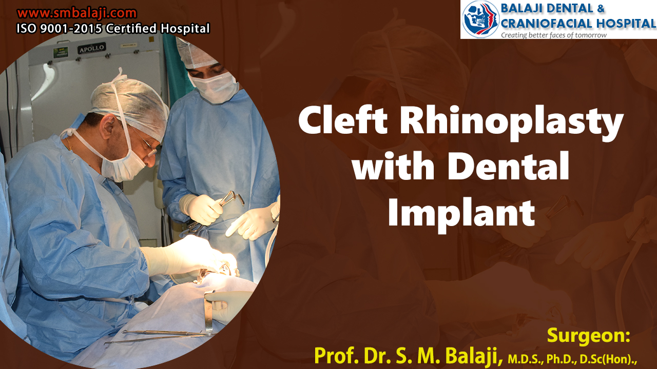 Cleft Rhinoplasty with dental implant