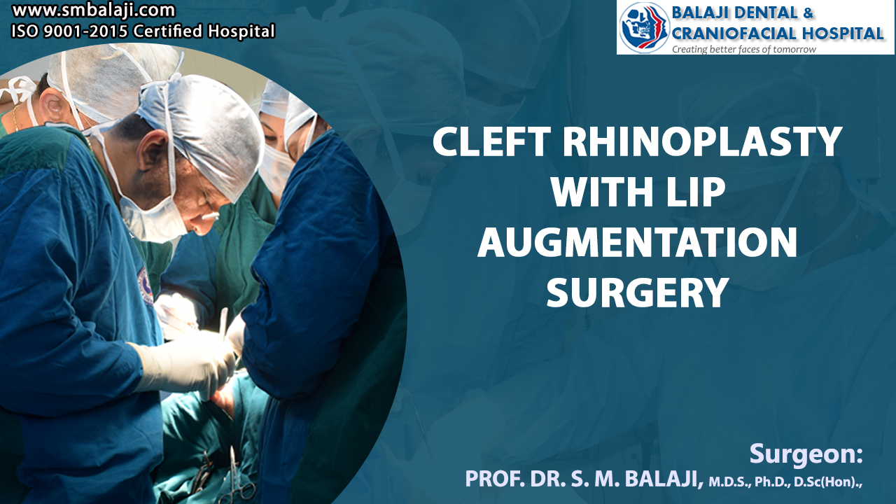 Cleft Rhinoplasty With Lip Augmentation Surgery