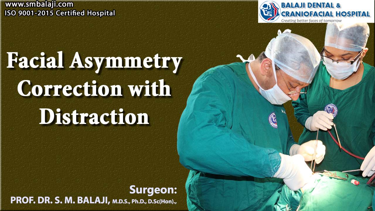 Facial Asymmetry Correction with distraction